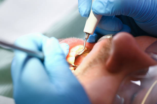 Best Emergency Tooth Extraction in Waycross, GA