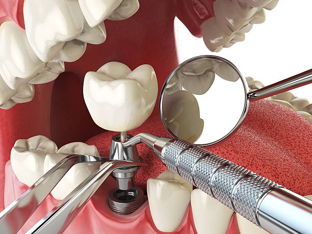 Best Emergency Tooth Extraction in Waycross, GA